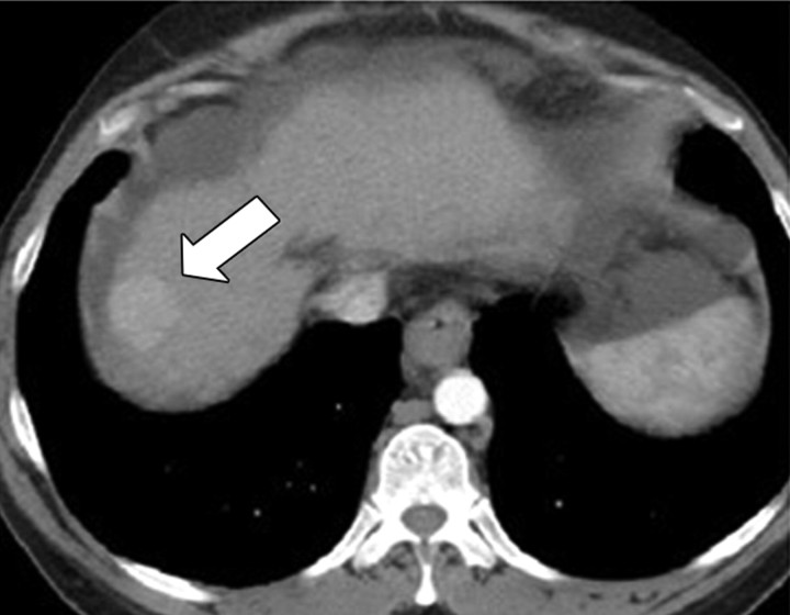 Figure 1c: