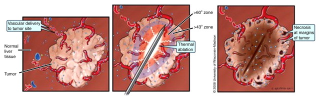 Figure 12: