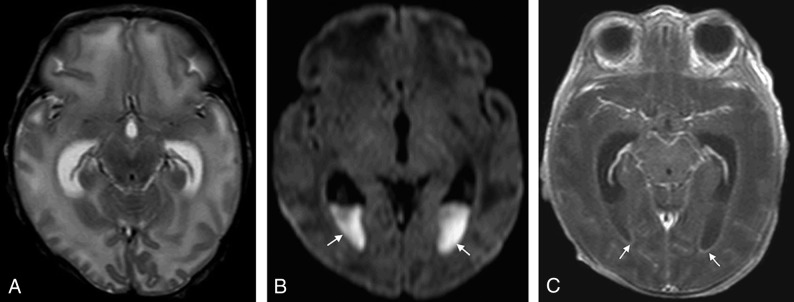 Fig 2.