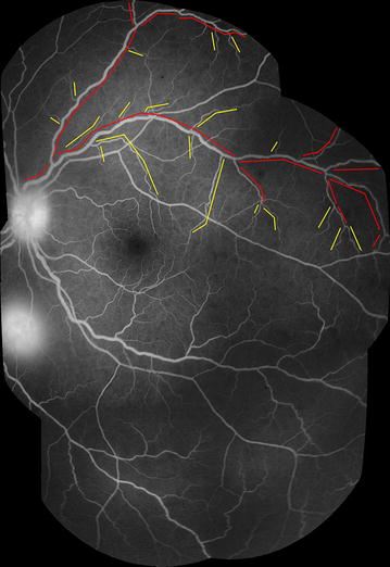 Fig. 4