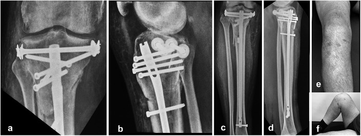 Fig. 6