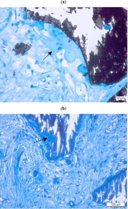 Fig. (3a,b)