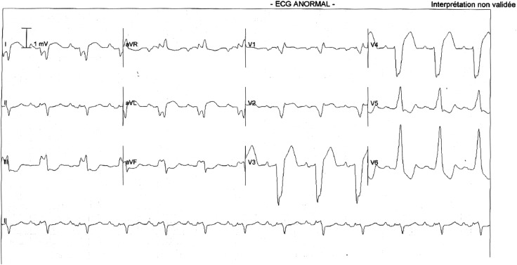 Figure 2