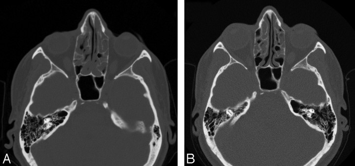 Fig 6.