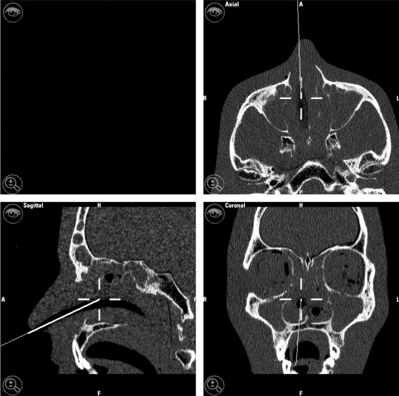 Fig 2.