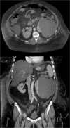 <b>FIG. 1.</b>