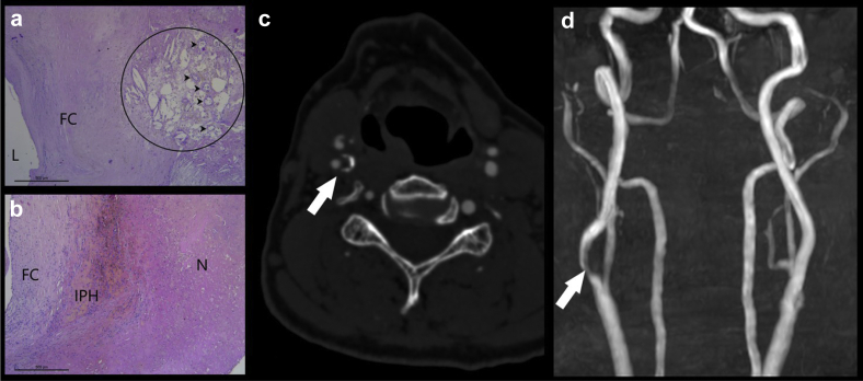 Fig 3