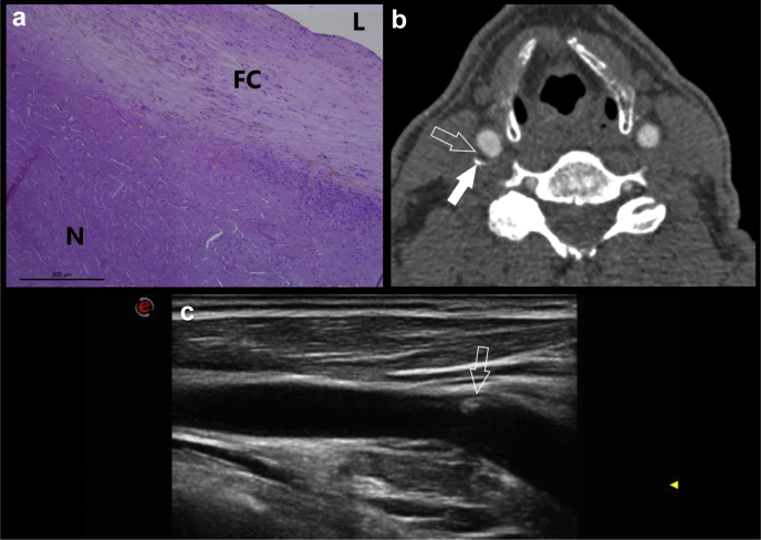 Fig 2