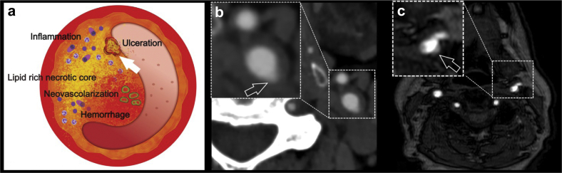 Fig 1