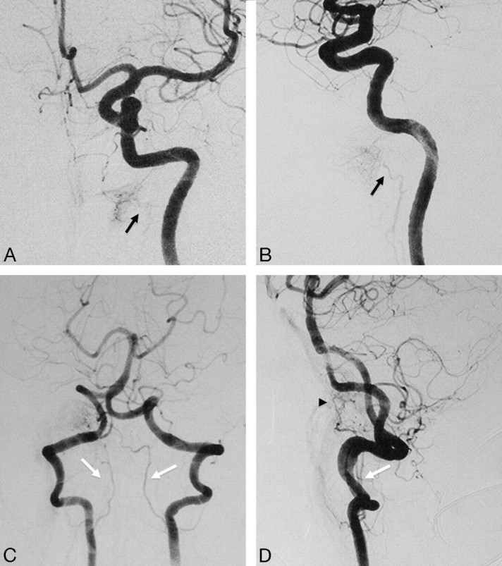 Fig 4.