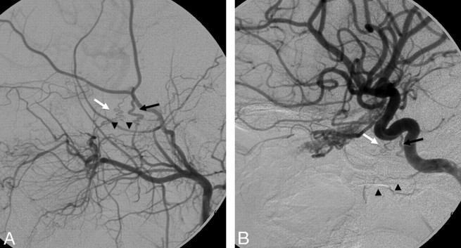 Fig 8.