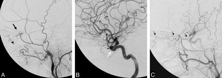 Fig 2.