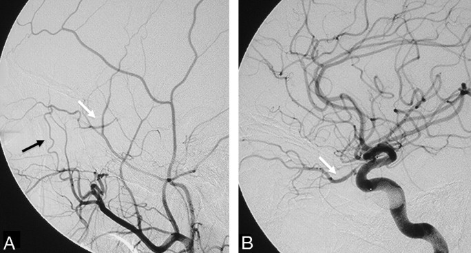 Fig 3.