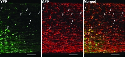 FIG. 11.