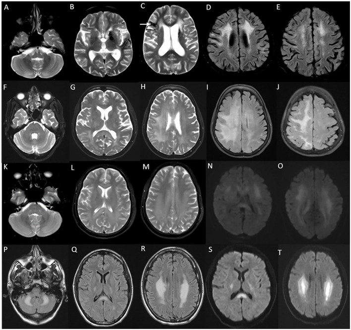 Figure 13