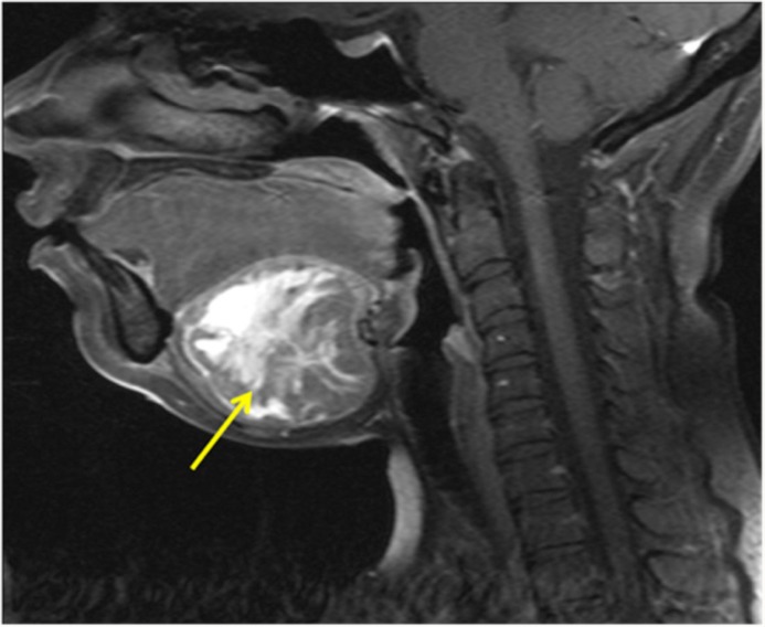 Figure 3: