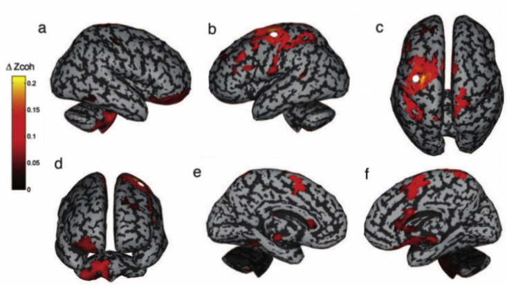 Fig. 2