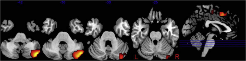 Fig. 3