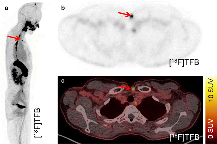 Fig. 4