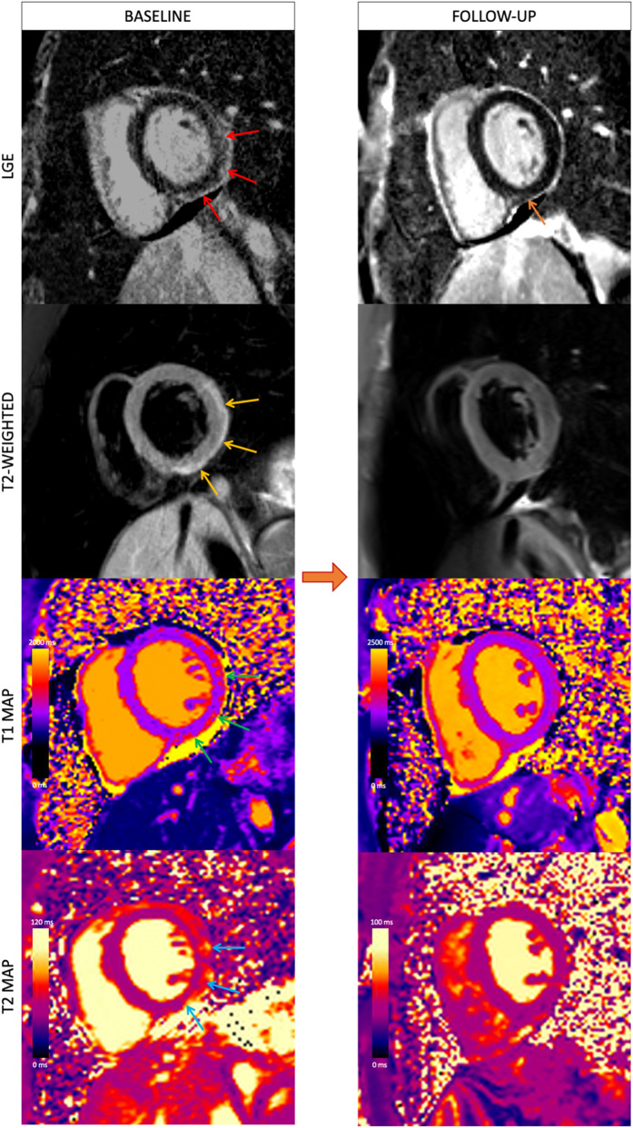 Fig. 4