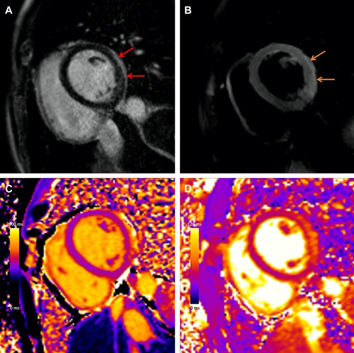 Fig. 3