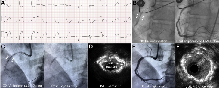 Figure 1