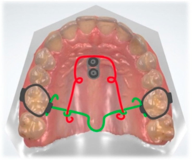 Figure 9
