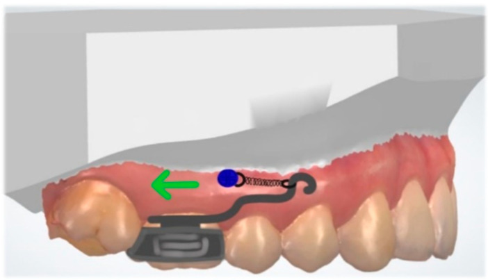 Figure 15