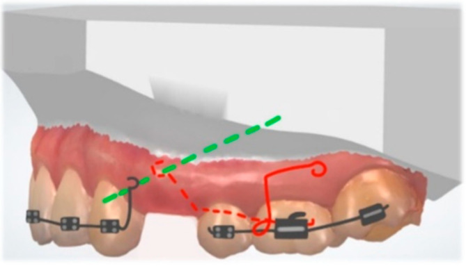 Figure 11