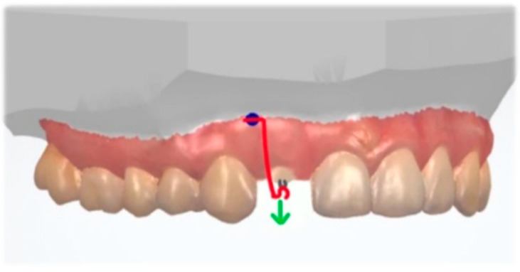 Figure 14