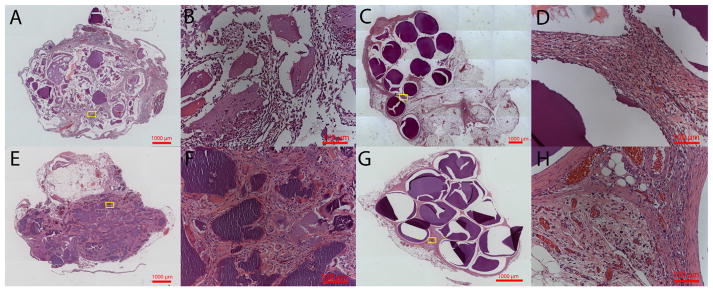 Fig. 12