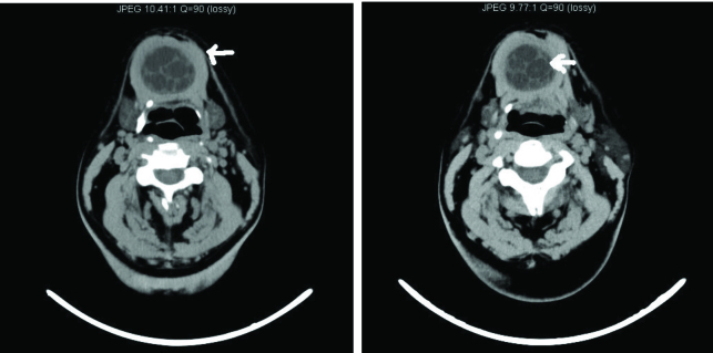 [Table/Fig-2A,B]: