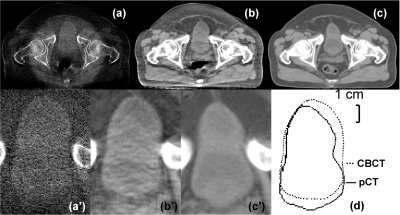 Figure 12