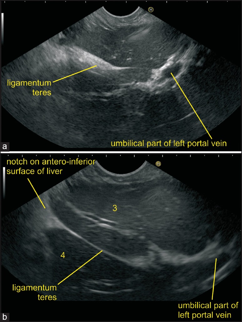 Figure 18