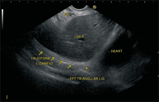 Figure 21