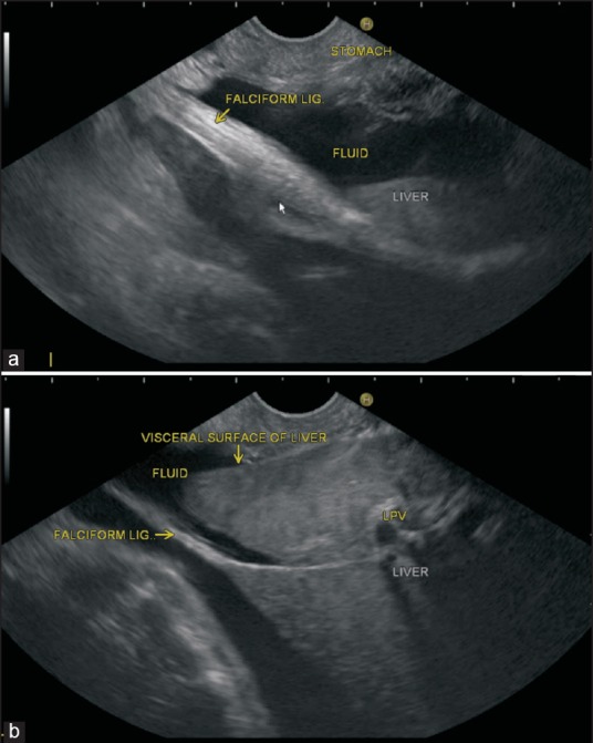 Figure 17