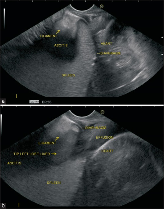 Figure 22