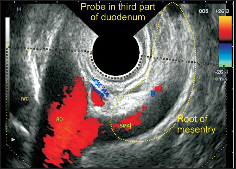 Figure 25