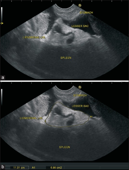 Figure 14