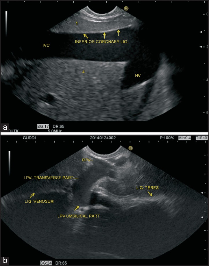 Figure 23