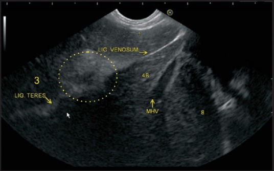 Figure 19