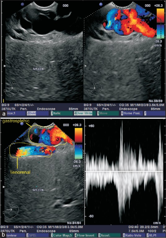 Figure 12