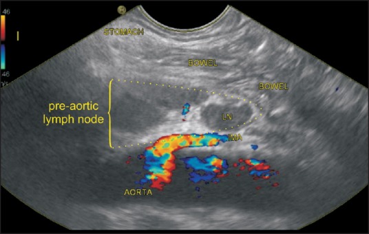 Figure 24