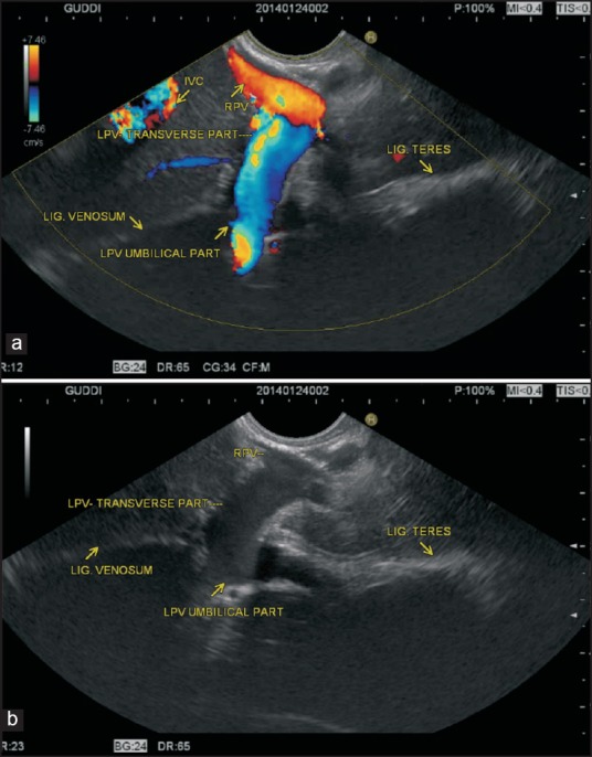 Figure 20