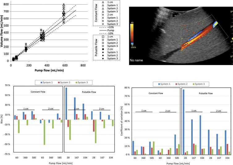 Volume flow computation of flow distal (downstream) to a 40% stenosis. Computed flow at c-planes (ie, the lateral elevational plane of equal distance from the transducer) located 1 and 2 cm past the stenosis at constant and pulsatile flow conditions. Top left graph shows computed volume flow as a function of pump flow. Constant flow is shown at 1 cm (∆) and 2 cm (×) distal (ie, downstream) to the stenosis and pulsatile flow at 1 cm (□) and 2 cm (●) distal (downstream) to the stenosis, respectively. For constant flow, bias and coefficient of variation are almost all less than 20%. Figure 2 shows analysis of these results. Example screenshot (top right) is shown for poststenotic flow. Bias at 1 and 2 cm poststenosis (bottom left) is shown and averaged between three sites. Coefficient of variation at 1 and 2 cm poststenosis (bottom right) is shown and averaged between three sites.