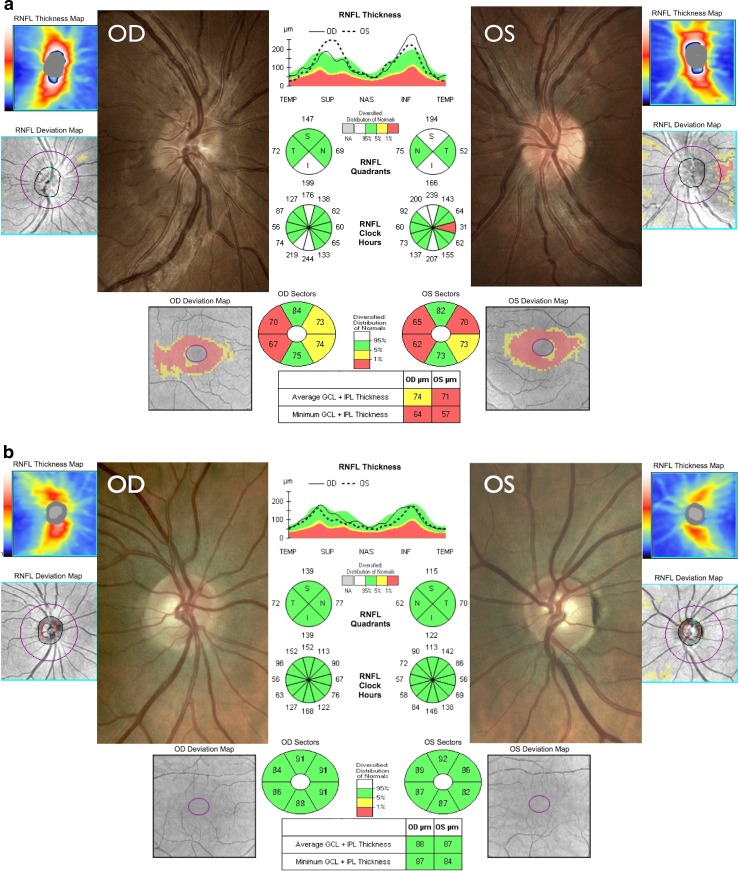 Fig. 1