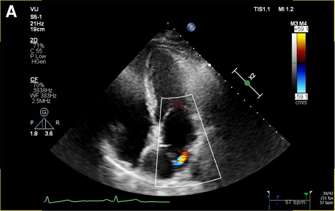 Figure 2