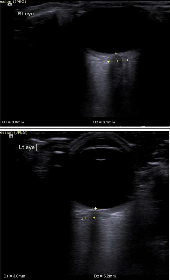 Figure 1 A