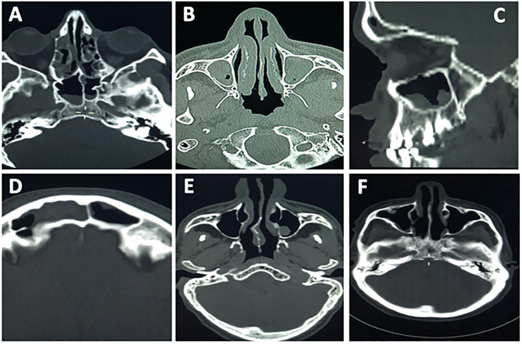 Fig 3