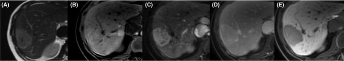 FIGURE 3